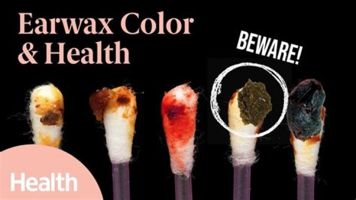 8 Things Your Earwax Says About Your Health Archives
