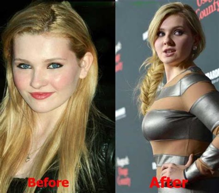 Abigail Breslin Plastic Surgery Before And After: Did She Get Nose Job Done?