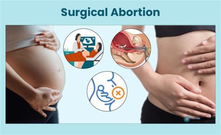 Abortion Archives - 247 News Around The World