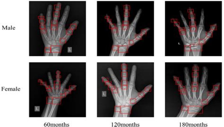 Age assessment Archives - 247 News Around The World