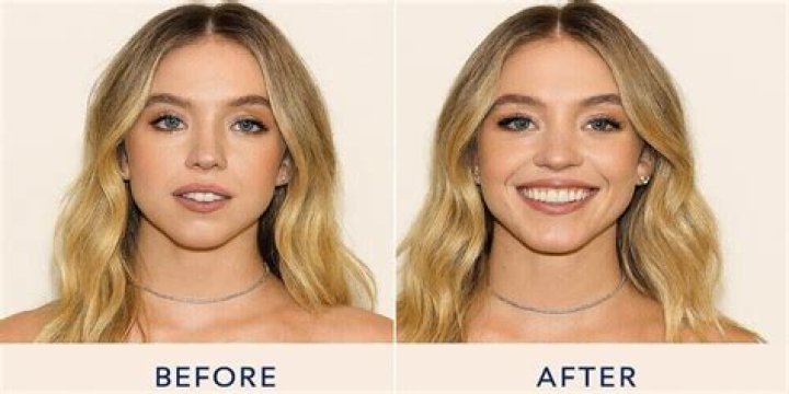 Alison Sweeney Plastic Surgery -Before And After Photos: Fans Suspect Her Facelift