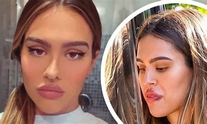 Amelia Hamlin shares VERY pouty selfie... after showing bruised lips in Malibu with Scott Disick