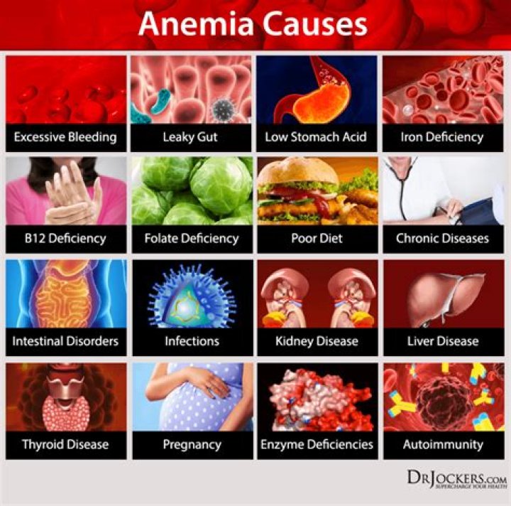 anemia causes Archives - 247 News Around The World