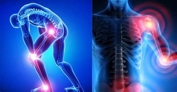 Arthritis Archives - 247 News Around The World