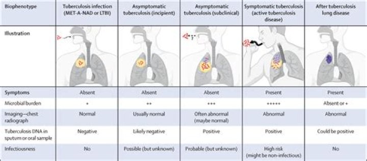 asymptomatic Archives - 247 News Around The World