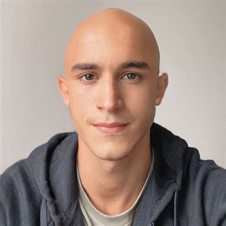 Bald Archives - 247 News Around The World