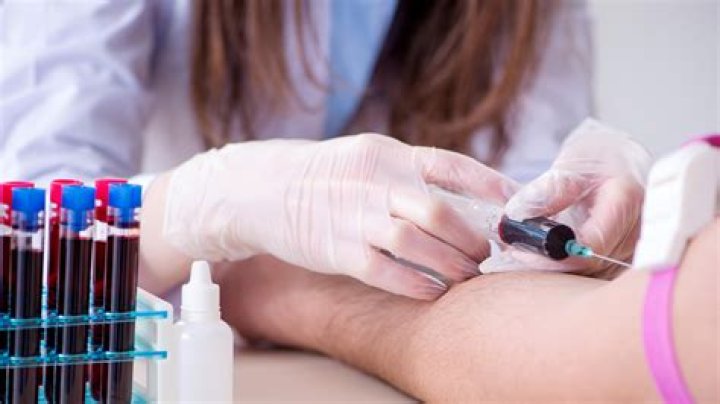 Blood Tests Archives - 247 News Around The World