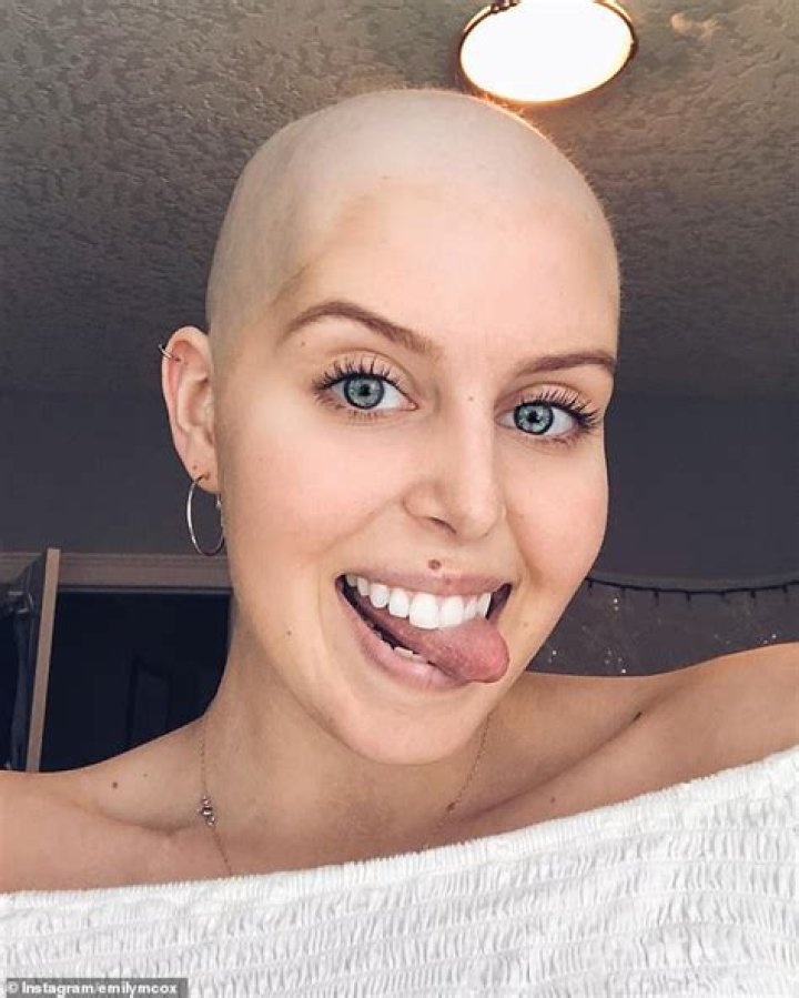 Bone cancer survivor, 24, documents the leg amputation she needed to save her life
