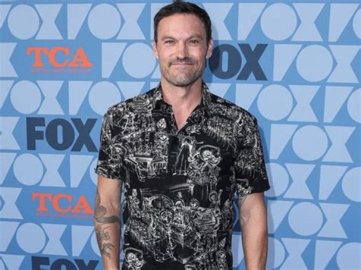Brian Austin Green reveals his Ulcerative colitis battle