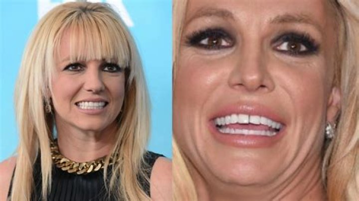 Britney Spears Fans Debate Her Teeth After She Leaves Comments On