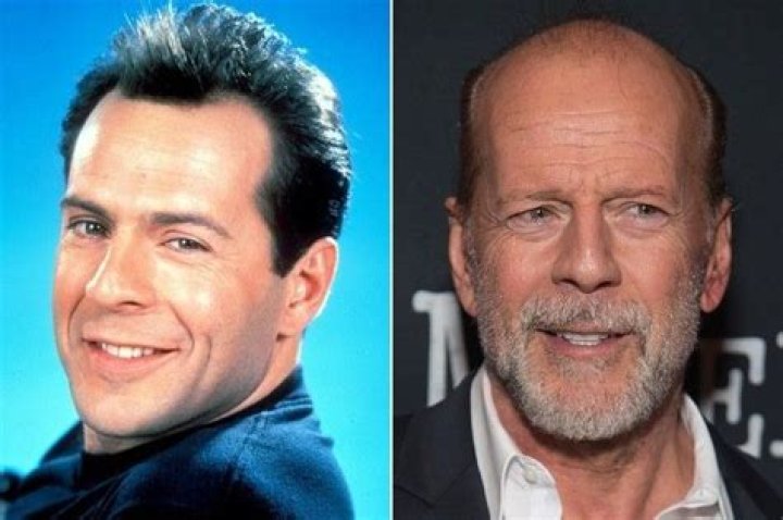 Bruce Willis Haircut: Why Is He Bald? Is He Suffering From Cancer Illness And Lost His Hair