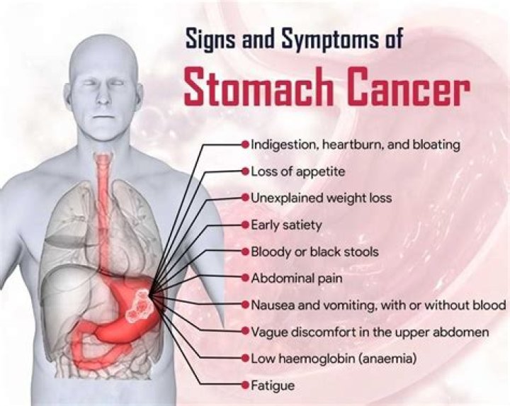 Cancer symptoms Archives - 247 News Around The World