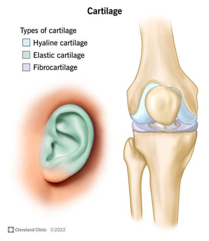 Cartilage Archives - 247 News Around The World