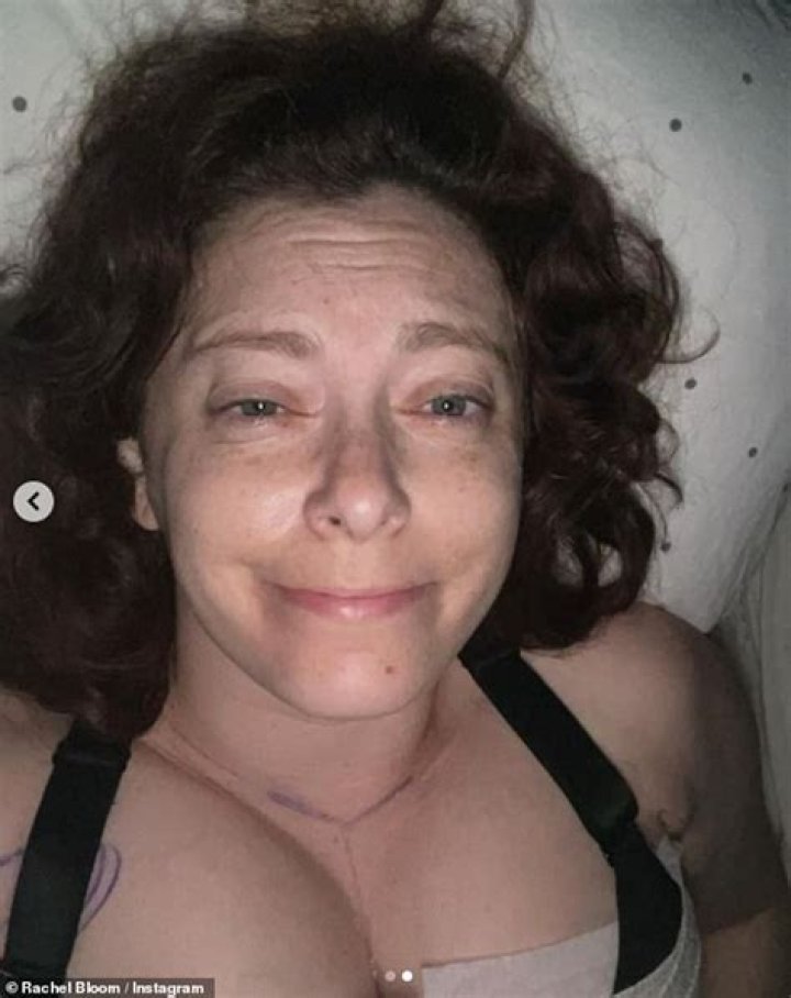 Crazy Ex-Girlfriend star Rachel Bloom has a breast reduction on her DD chest