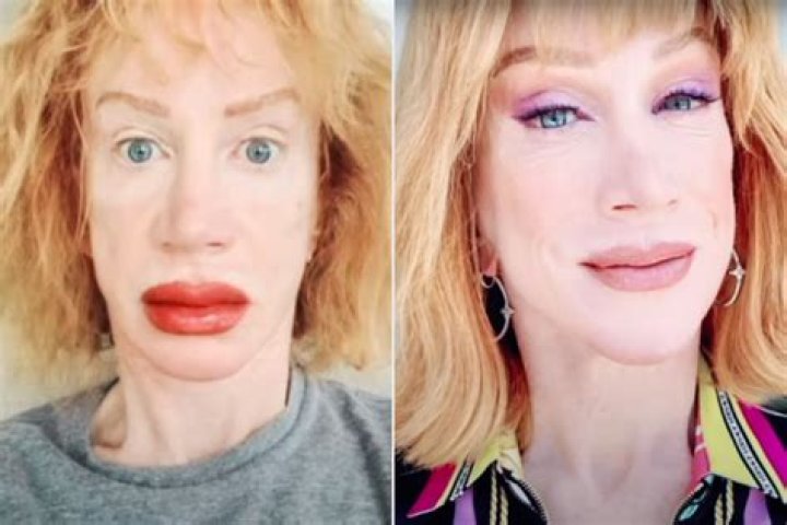 Did Angela Yellowstone Get Lips Surgery? Before And After Photos