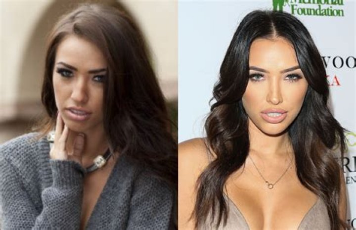 Did Bre Tiesi Have Plastic Surgery?