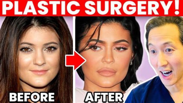Did Gabimfmoura Get A Plastic Surgery? Explore Her Before And After Pictures