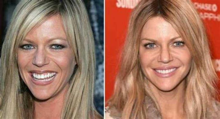 Did Kaitlin Olson Undergo Plastic Surgery? As She Dee From Always Sunny