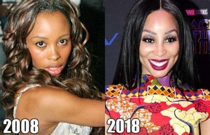 Did Khanyi Mbau Undergo Plastic Surgery? Before And After - Age Height And Body Measurements