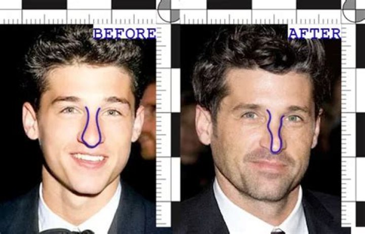 Did Patrick Dempsey Undergo Plastic Surgery On His Nose? Family And Net Worth