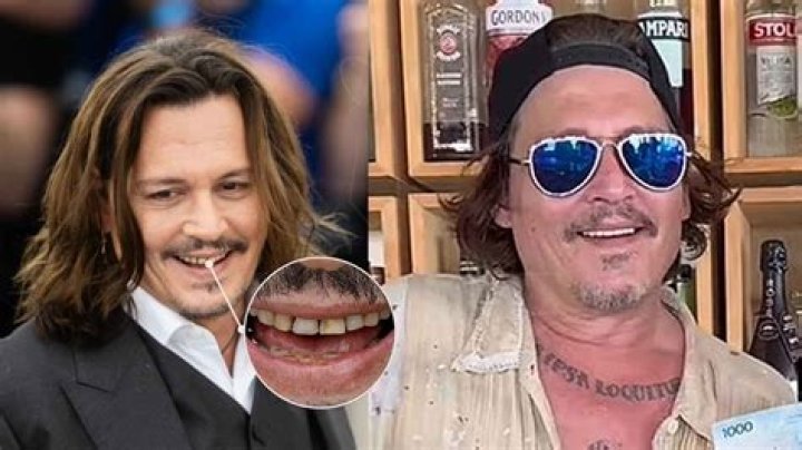Did Use Of MDMA Cause Johnny Depp Stuttering Problem? The Impact On Speech Impediment Explored