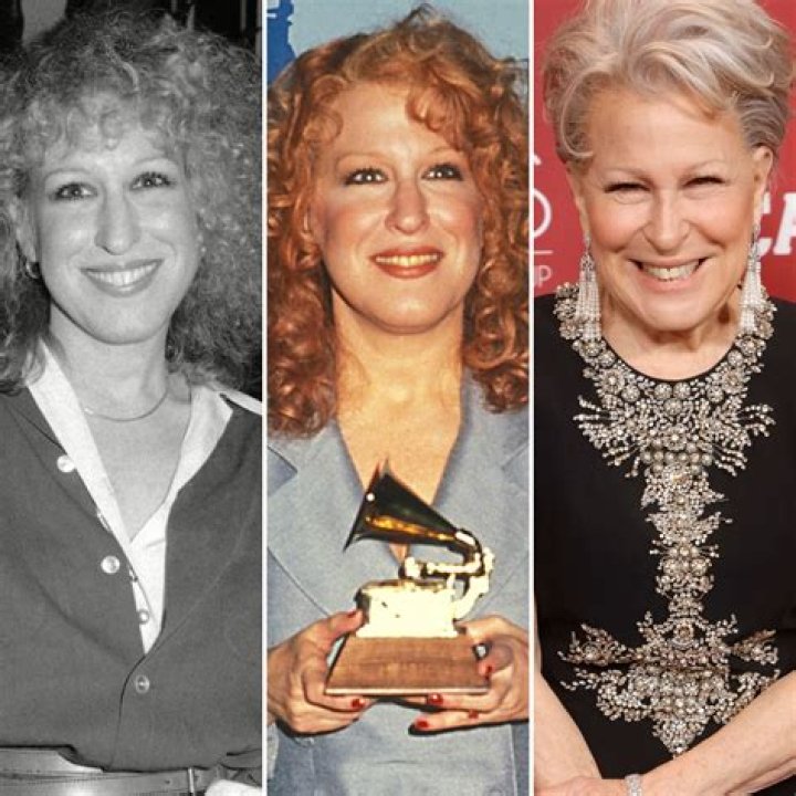 Does Bette Midler Had Nose Job And Botox Plastic Surgery? Before And After Photos – Has Don Facelift?