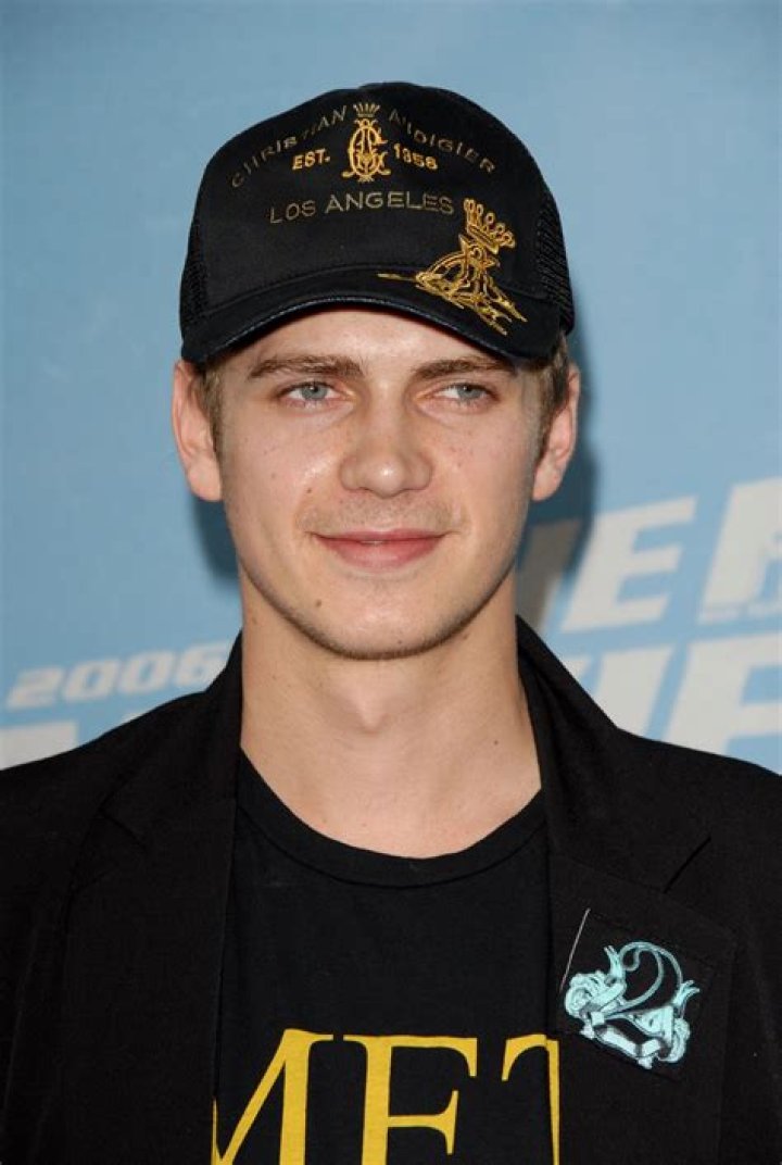 Does Hayden Christensen Undergo Plastic Surgery? Before And After Photos