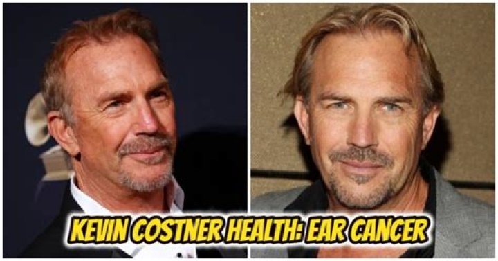 Does Kevin Costner Have Ear Cancer? What Is Wrong With Kevin Costner Left Ear? Cancer and Health Update