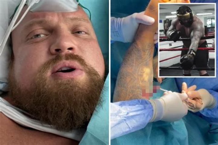Eddie Hall confirms he suffered DETACHED BICEP & has undergone surgery as fight with rival Hafthor Bjornsson called off