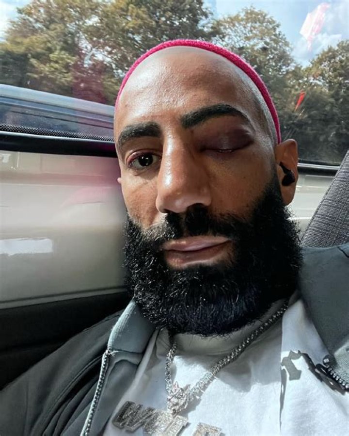 Fousey: Who Is The Famous Youtuber? The Untold Truth About Fousey Hair Tattoo, What Happened To His Head and Face?