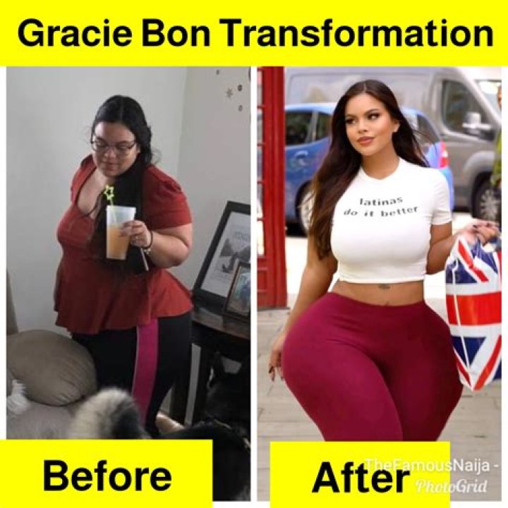 Gracie Bon Before And After Plastic Surgery: Who Was Her Surgeon? Transformation Explored