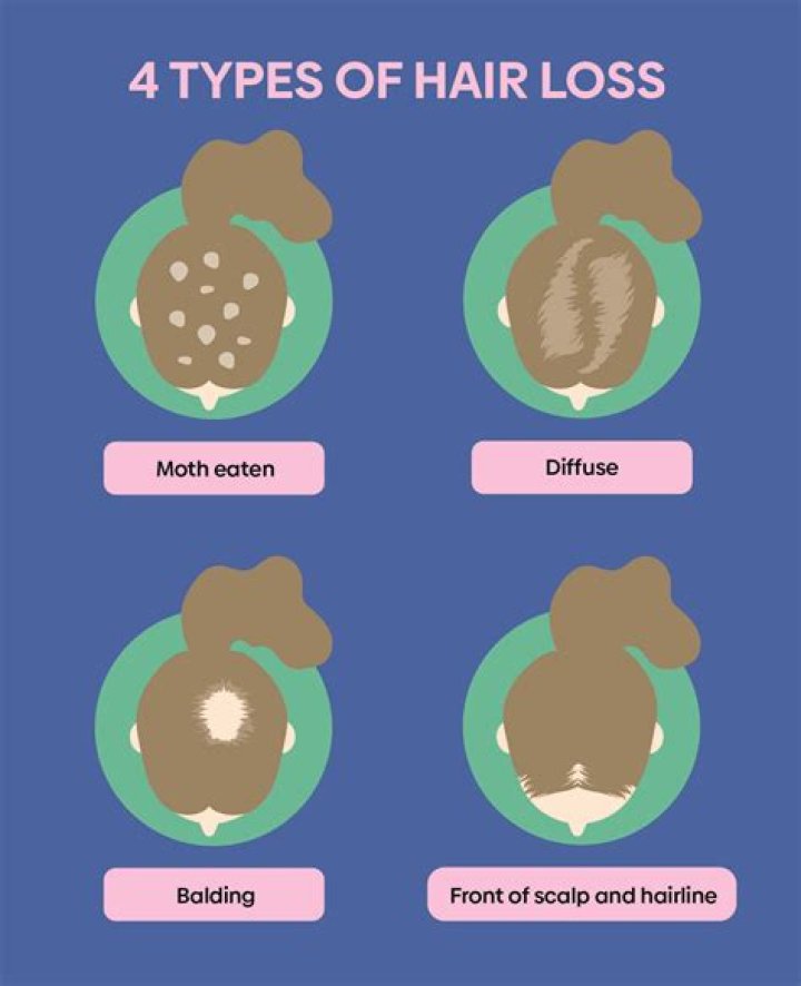 Hair loss: Causes include mercury - watch out for fish such as sushi