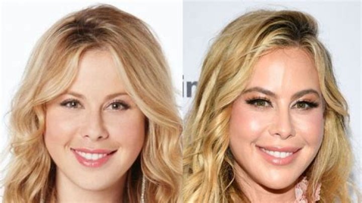 Has Tara Lipinski Undergone Plastic Surgery? Know More About His Family And Net Worth