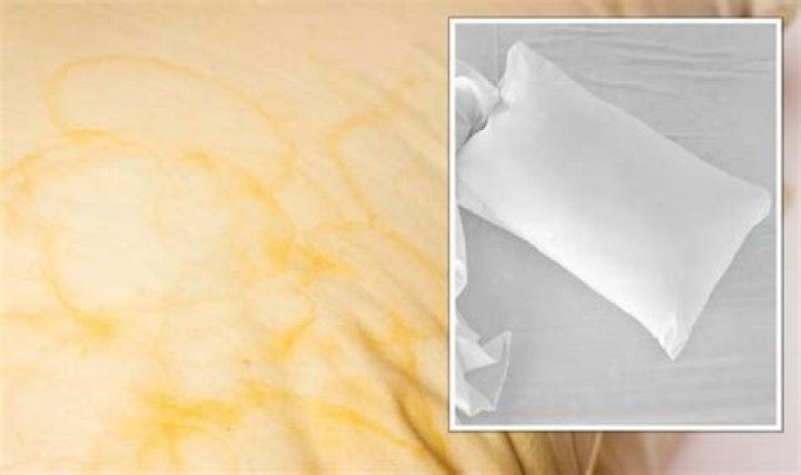 How to remove yellow stains from white pillowcases in five minutes without bleach