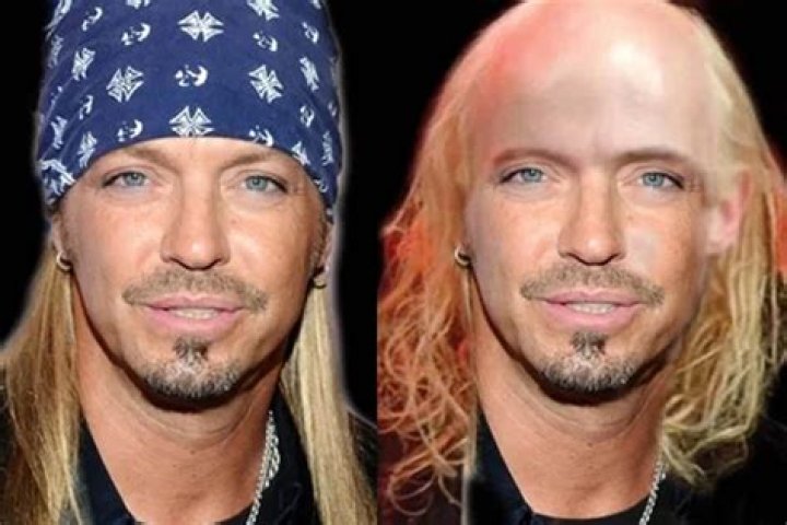 Is Bret Michaels Bald Without Wig, What Happened To His Hair? Before and After Pics