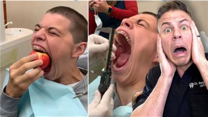 'It's hard for me to go places!'