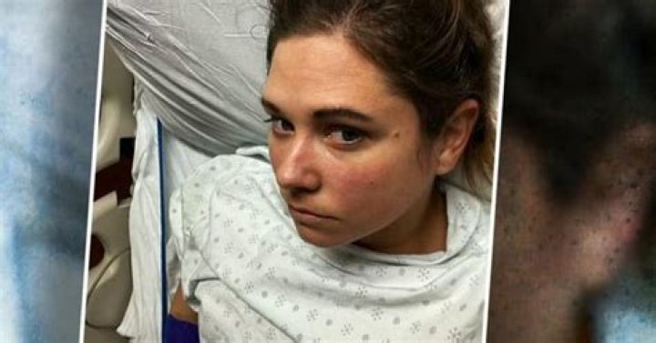 Job applicant discloses cancer diagnosis in interview