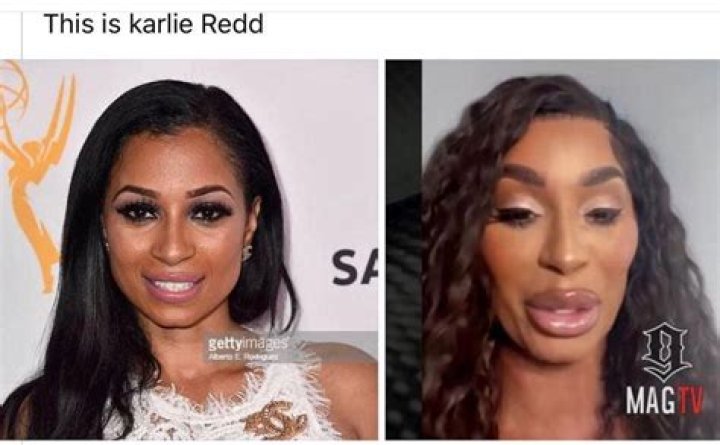Karlie Redd New Face & Plastic Surgery: Before After Photos Hints Its More Than Lip Injections