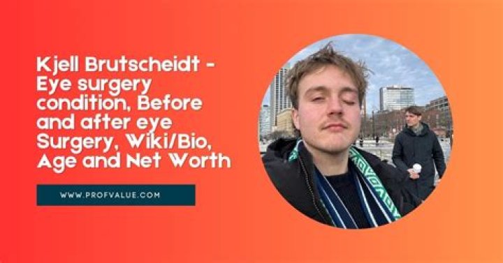 Kjell Brutscheidt Eye Accident And Surgery: What Happened? Before And After Photos