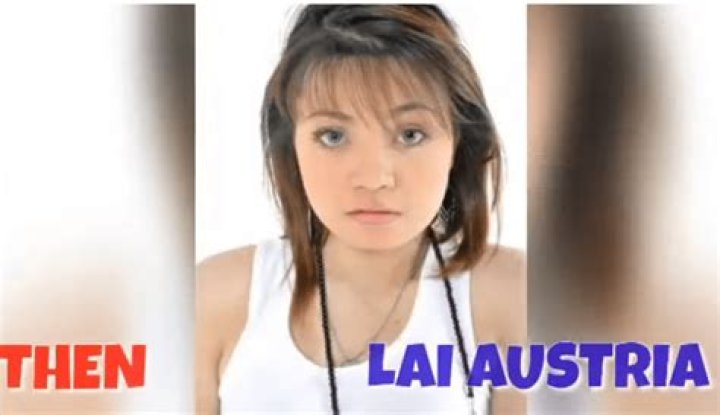 Lai Austria Without Surgery: Who Is She Dating? Boyfriend And Her Plastic Surgery Before And After