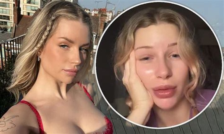 Lottie Moss claims rehab stint was the 'best thing ever' for her mental health