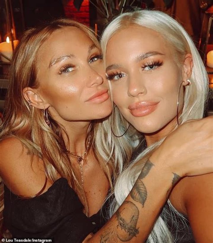 Lottie Tomlinson Sister Before and After Photos: Louis Tomlinson Announces Pregnancy News On Instagram