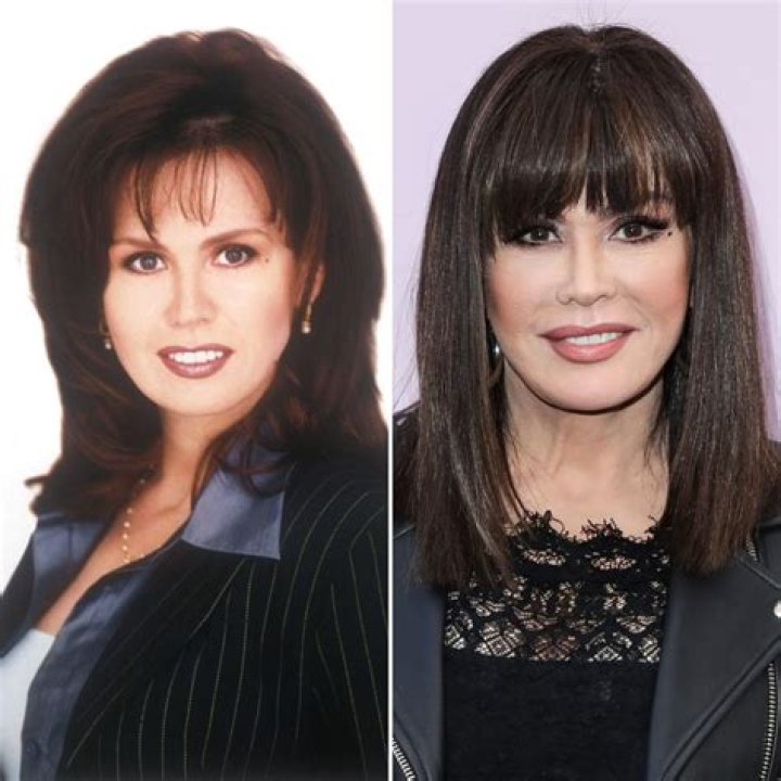 Marie Osmond Plastic Surgery: How It Impacted Her Career and Image