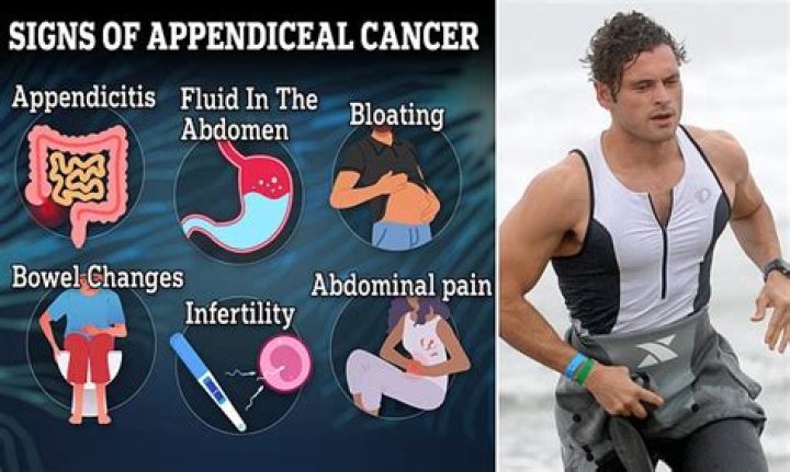 Mysterious rise in appendix cancer in young people: Disease that killed Designated Survivor star Adan Canto at just 42 has soared 200% in under-50s since 2000