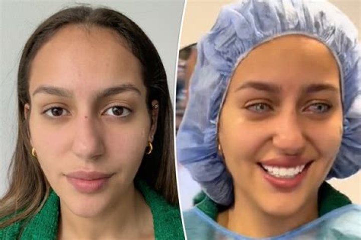 RHONJ: Did Joe Benigno Undergo Eye Surgery? Fans Are Worried About His Health