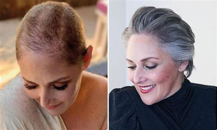 Ricki Lake, 53,  shows off her incredible one-year hair transformation in before and after photos