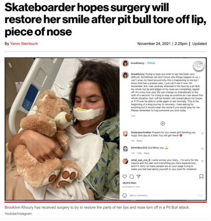 Skateboarder hopes surgery will restore her smile after pit bull tore off lip, piece of nose