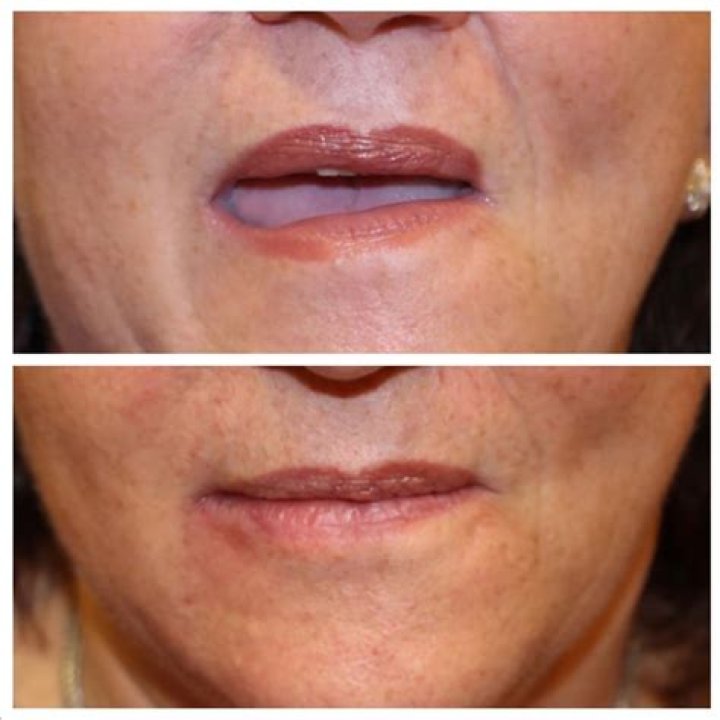 'Skin Decision' re-thinks the classic makeover show to reveal an overlooked side of plastic surgery - CNN Archives