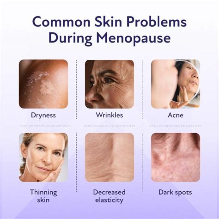 Sophie Wessex health: Menopause causes royal to ‘suddenly’ forget things - symptoms