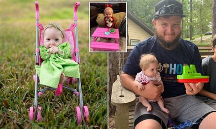 Tiny toddler, two, was born with rare form of dwarfism, weighs only 7lbs